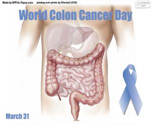 Rompicapo di Giornata mondiale contro il cancro al colon