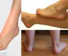 La caviglia è la parte della gamba posta immediatamente al di sopra del piede