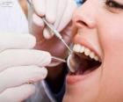Checkup dentale